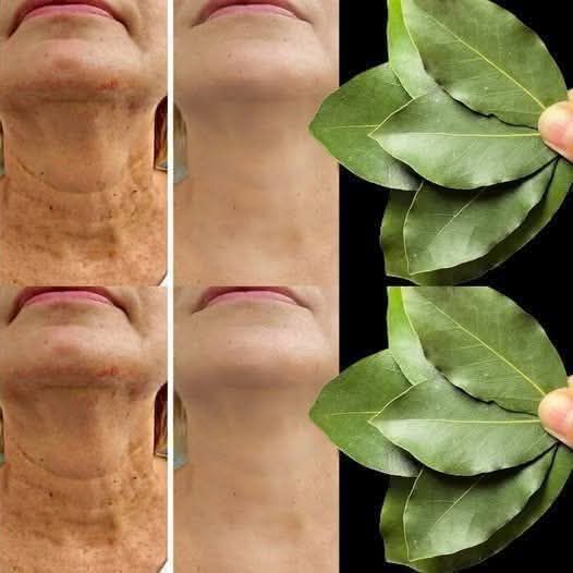 Bay leaf is 100000 times stronger than Botox. It erases all wrinkles even at the age of 70